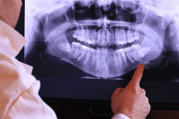 Best Emergency Treatment for Toothache in Lake Landor, VA